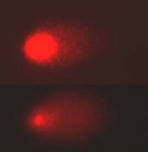 Fluoreszenzmikroskopische Aufnahme geschädigter DNS